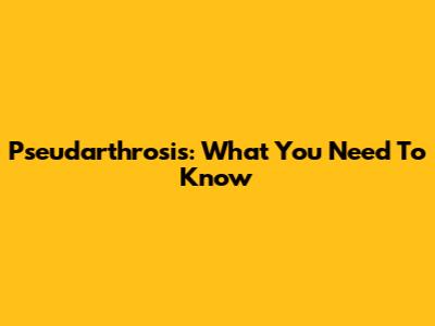 Pseudarthrosis: What You Need To Know